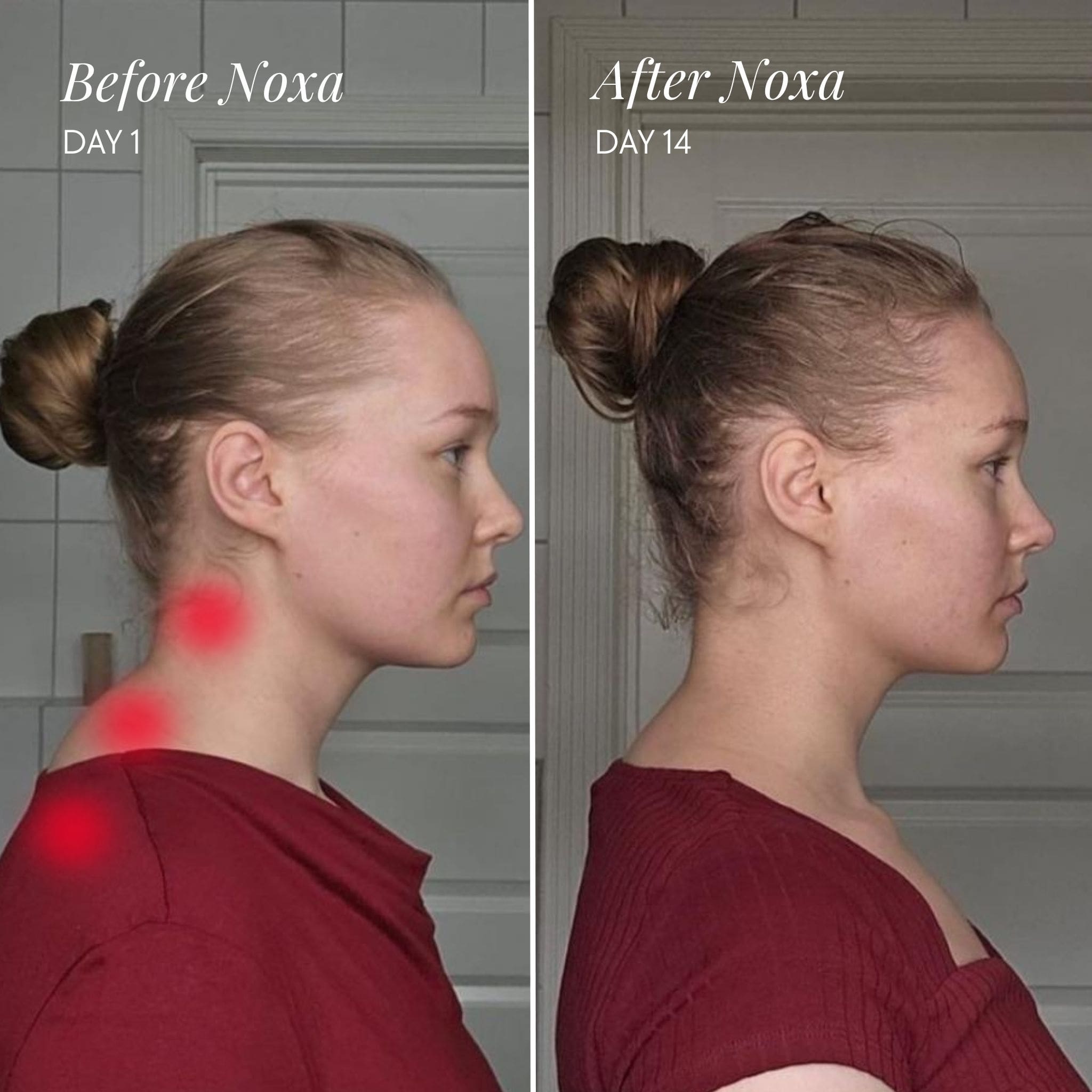 Noxa Neck and Shoulder Massager