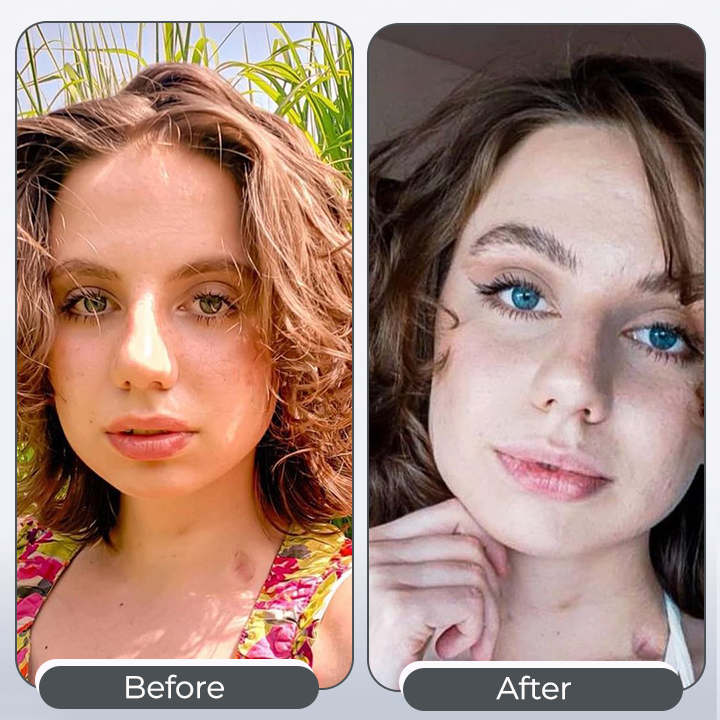 FancyDrop™ Color-Changing Eye Drops 💦— Transform Your Eye Color Naturally in Just 2 Hours