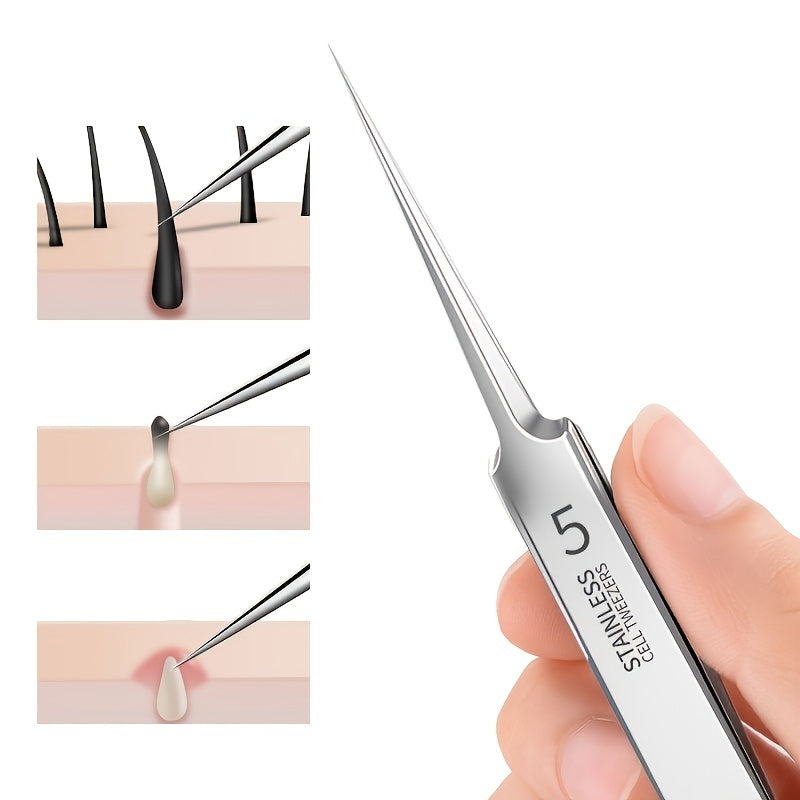 Ultra-Fine Professional Facial Blackhead Remover Tweezers