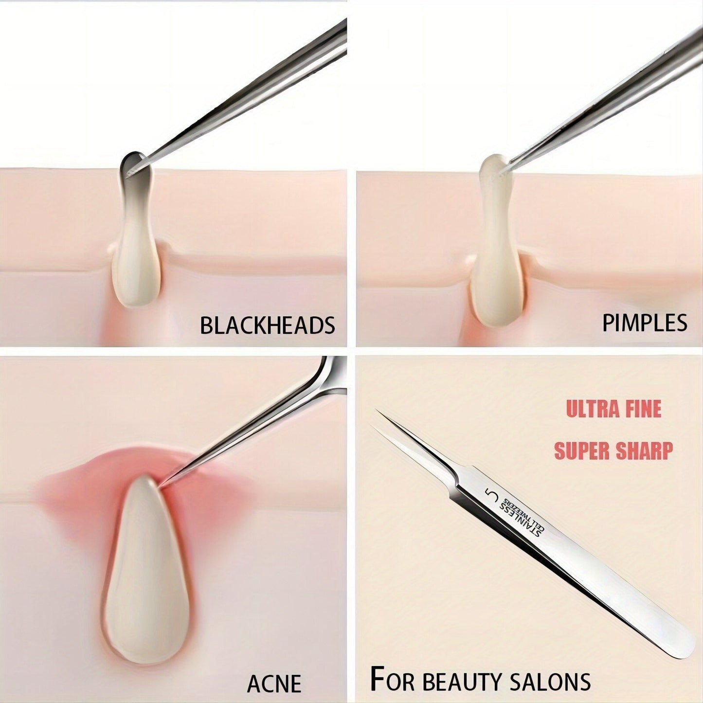 Ultra-Fine Professional Facial Blackhead Remover Tweezers