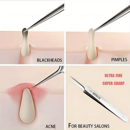 Ultra-Fine Professional Facial Blackhead Remover Tweezers
