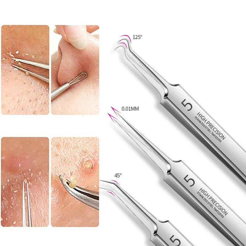 Ultra-Fine Professional Facial Blackhead Remover Tweezers