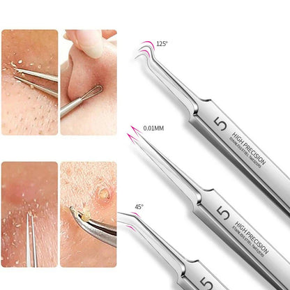 Ultra-Fine Professional Facial Blackhead Remover Tweezers