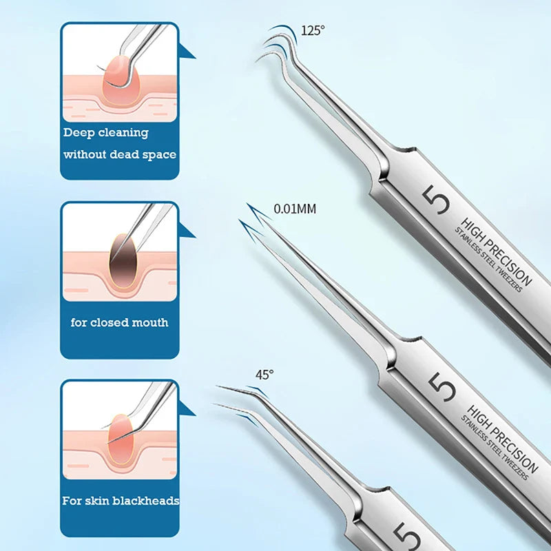 Ultra-Fine Professional Facial Blackhead Remover Tweezers
