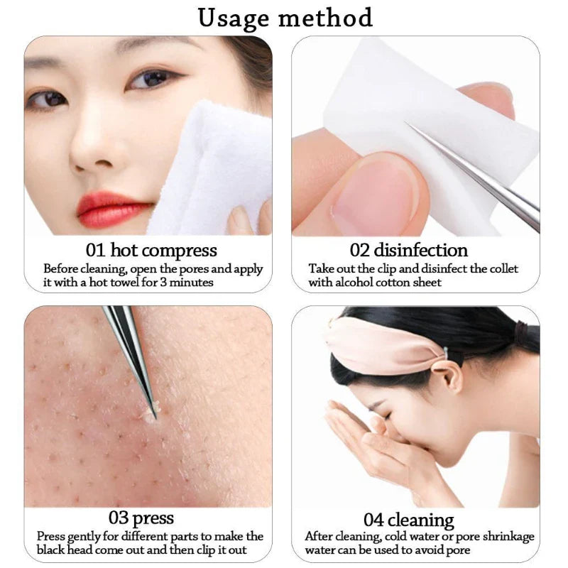 Ultra-Fine Professional Facial Blackhead Remover Tweezers